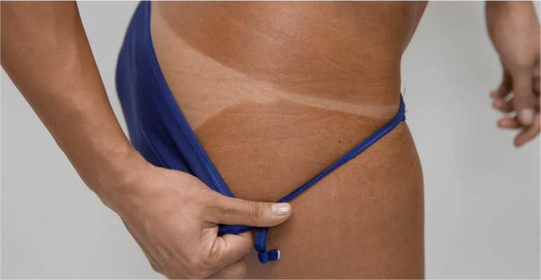 sunless tanning
